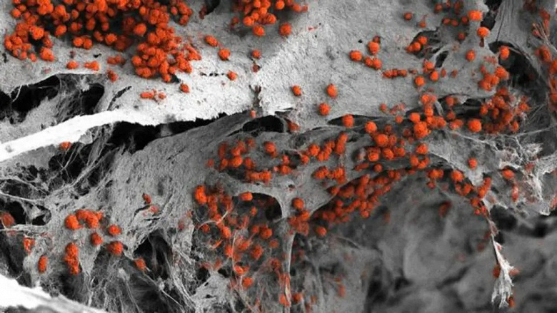 A Groundbreaking Step